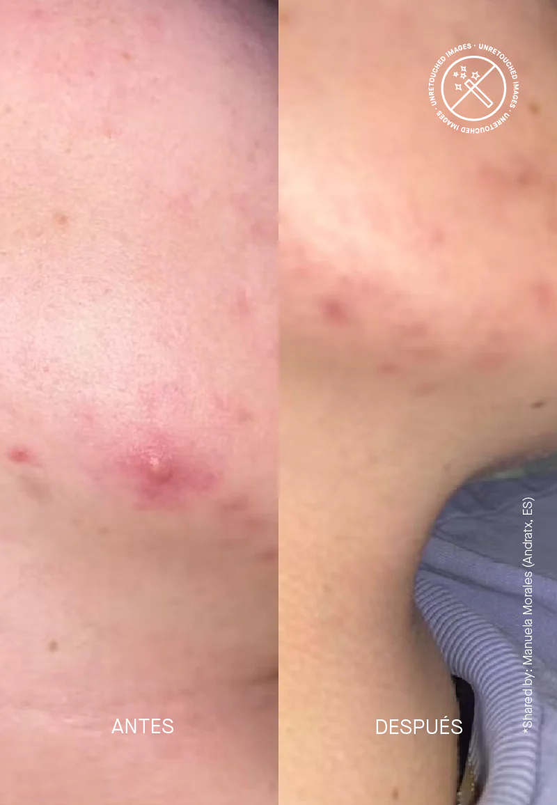 Zitcontrol® - Image 9